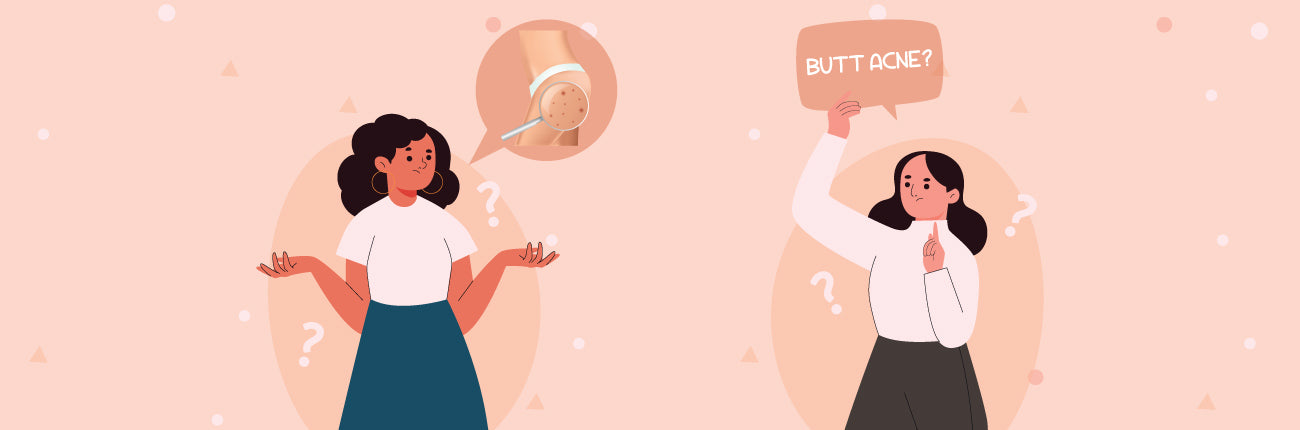 This is an image for What is Butt Acne and ways to deal with it on www.sublimelife.in
