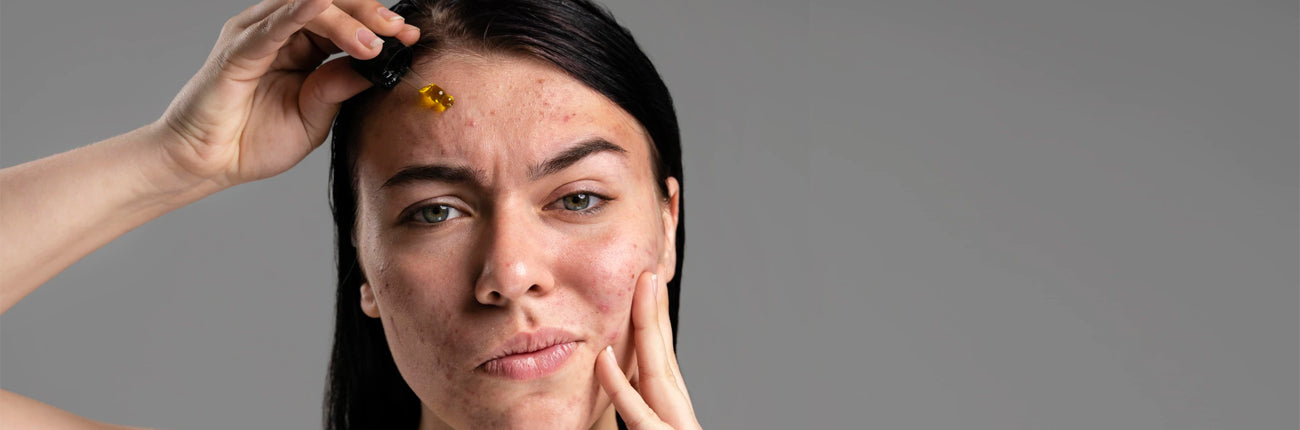 This is an image of 5 Ingredients to fight Pigmentation on www.sublimelife.in