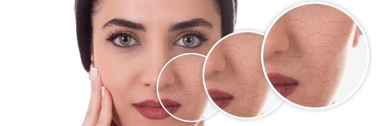 This is a header image of Here are game changing tips to take care of dry skin on www.sublimelife.in