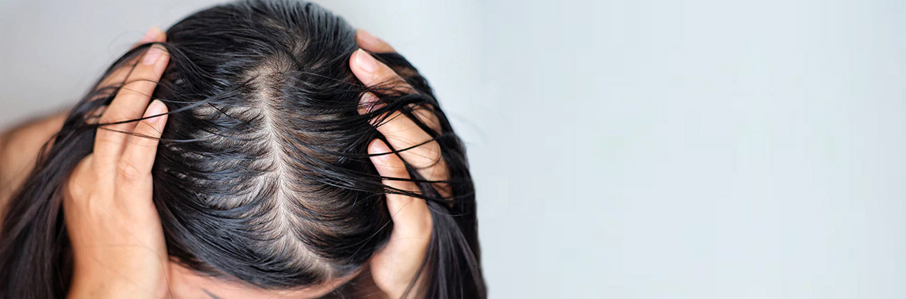 This is an image of a blog on Best tips for oily hair on www.sublimelife.in