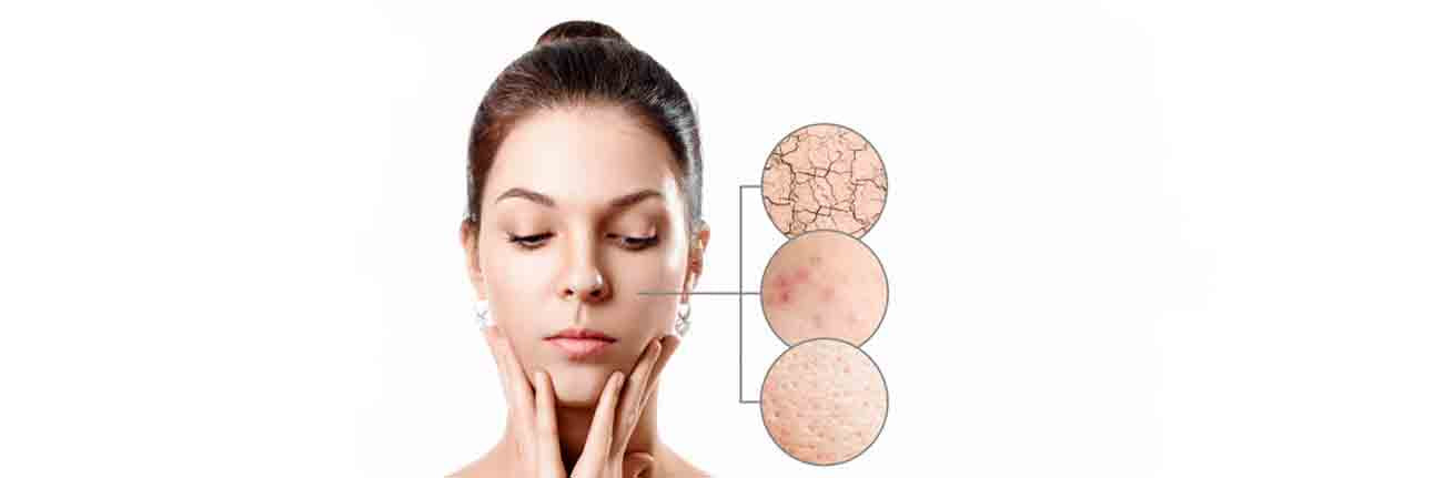 This is a header image for a blog on skincare routines for teens on ww.sublimelife.in