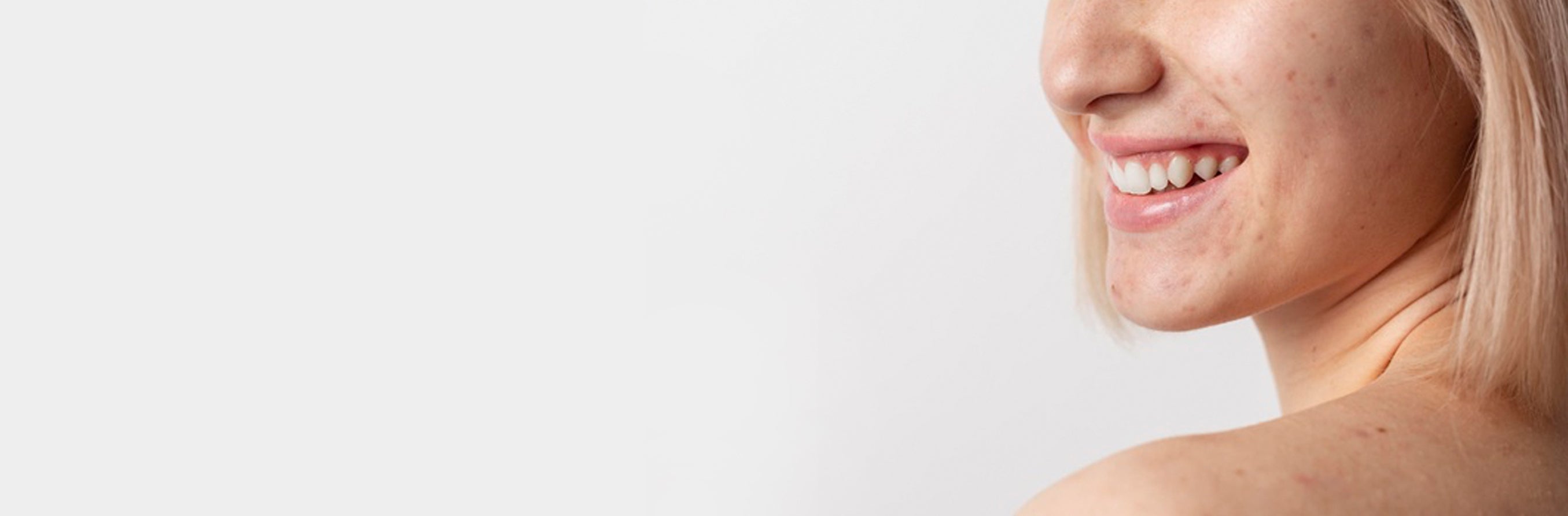 This is an header image of a blog on Congested Skin on www.sublimelife.in