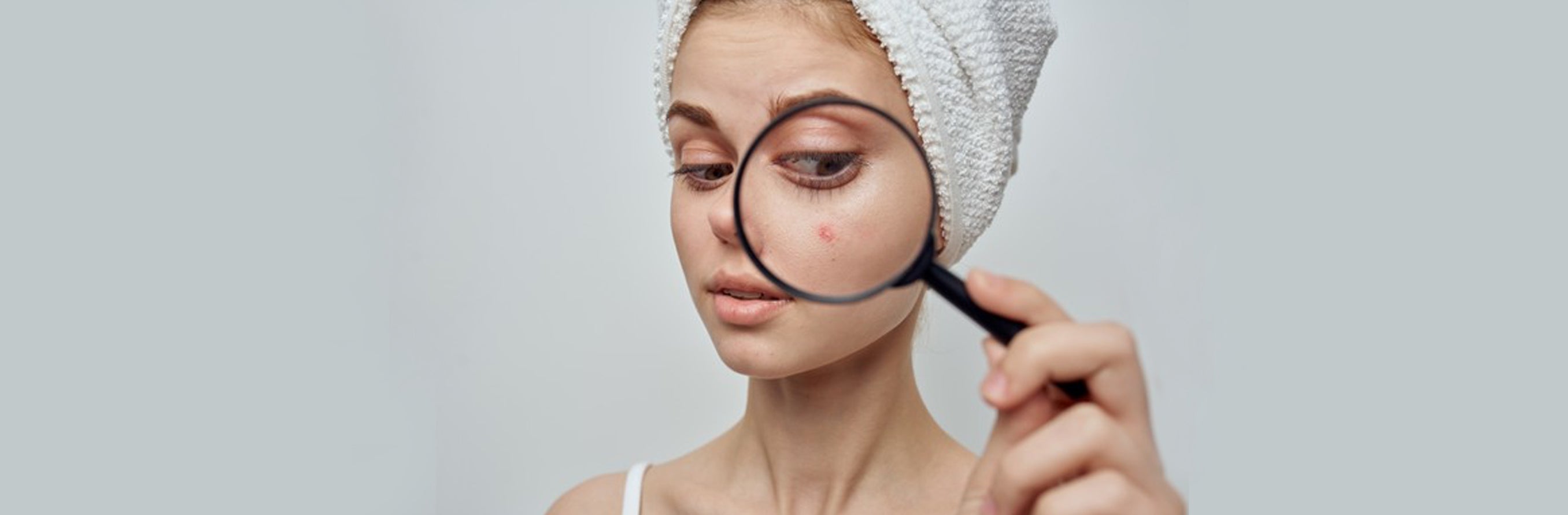 This is an image for a blog about Fungal Acne on www.sublimelife.in