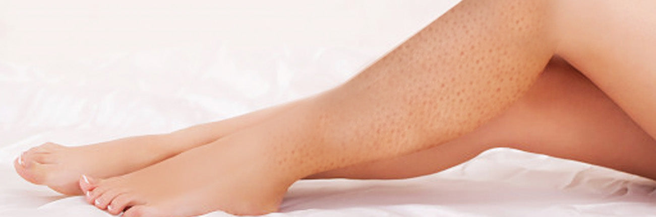 This is an image of an article on strawberry skin on www.sublimelife.in.