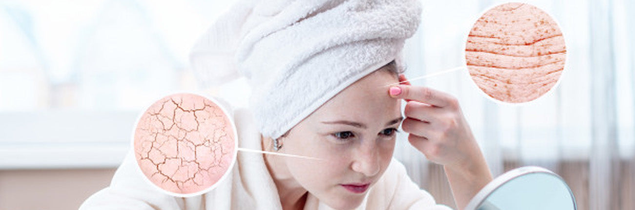 This is an image of an article on winter and summer skincare on www.sublimelife.in.