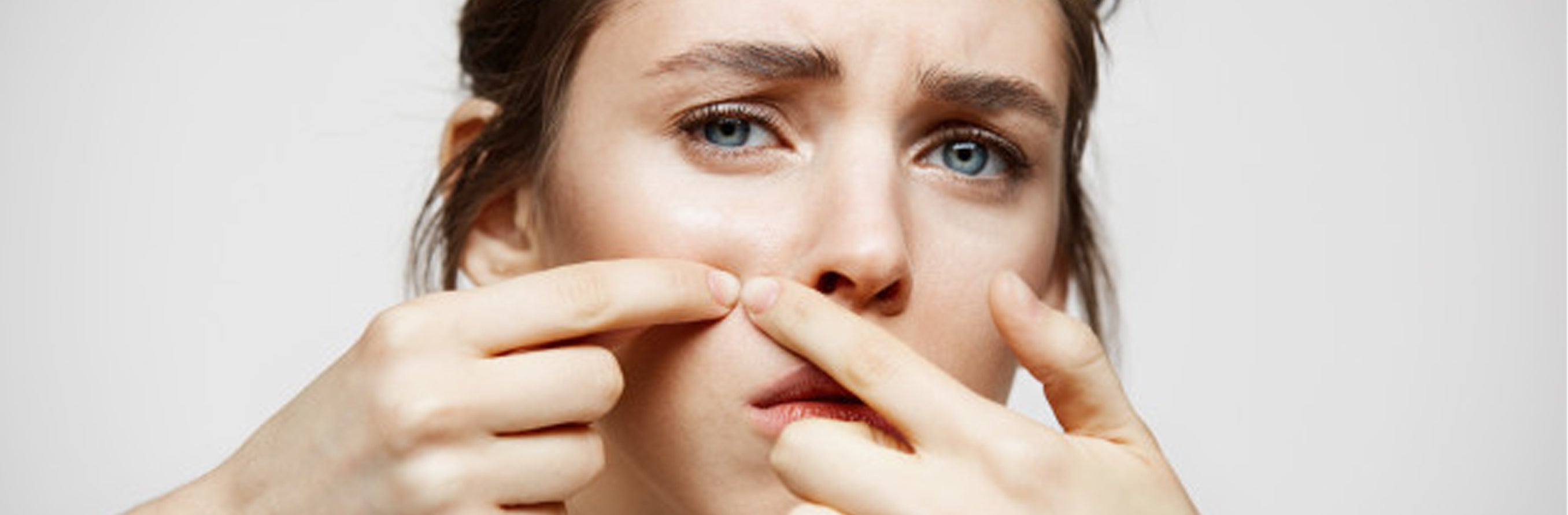 This is an image for a blog on whiteheads and how to deal with them on www.sublimelife.in