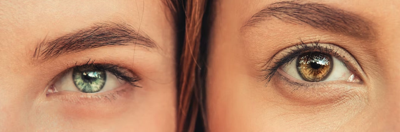 This is a header image of How To Take Care Of Crepey Eyes? on www.sublimelife.in