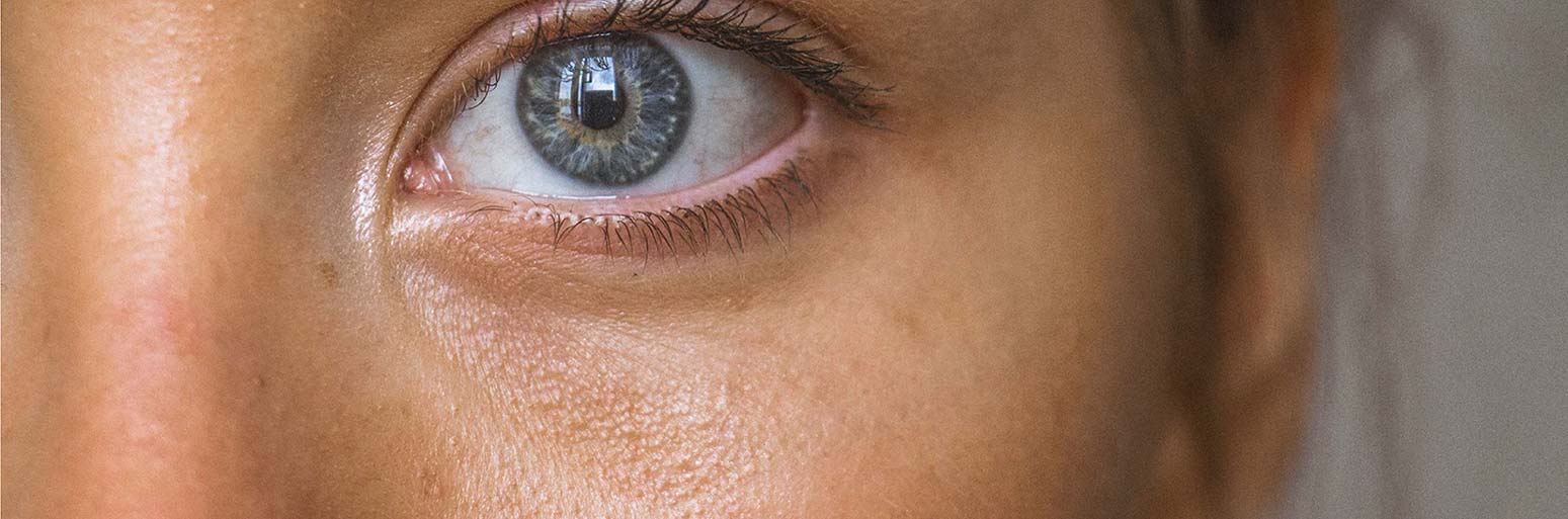 This is an image of how to minimise and manage large or open pores on sublimelife.in.