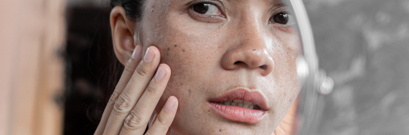 This is an image for a blog on Why Hyperpigmentation products aren't working on www.sublimelife.in 
