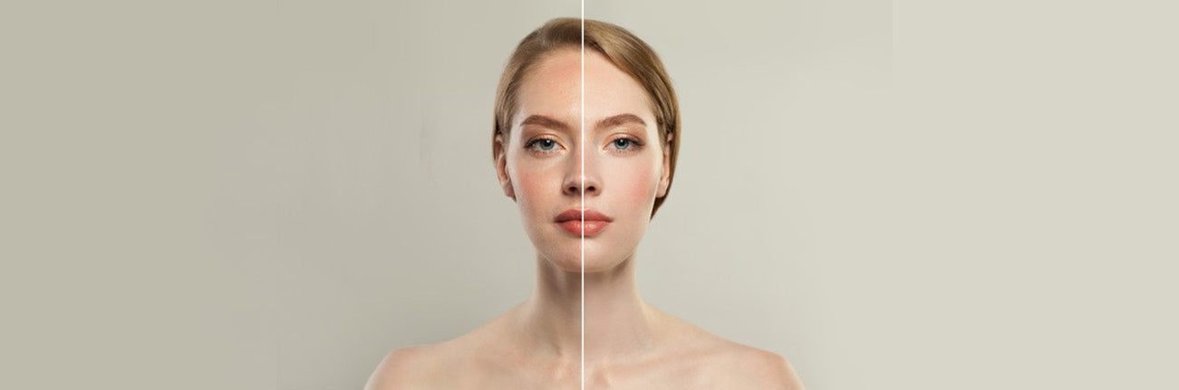 this is an image of how to reduce dull skin on sublimelife.in